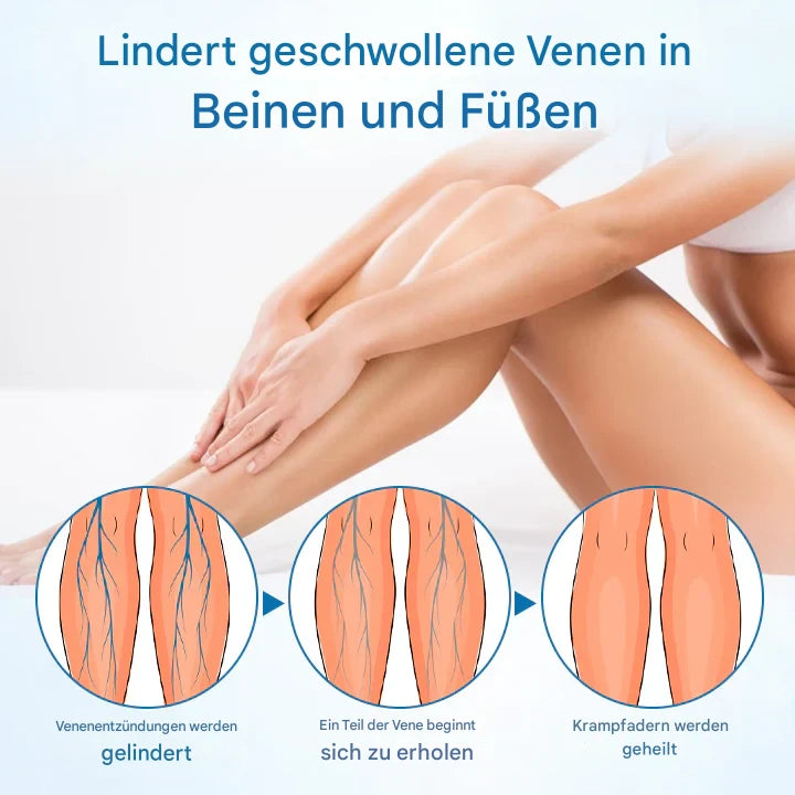 Timilk® VeinGuard Herbal Spray-✅ Clinically proven to eliminate varicose veins in just 7 days!