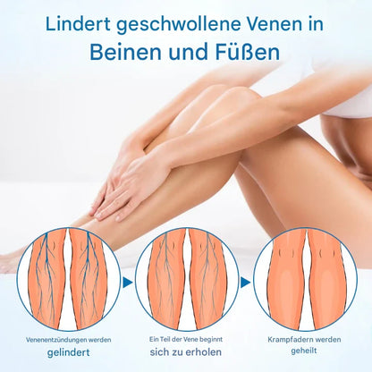 Timilk® VeinGuard Herbal Spray-✅ Clinically proven to eliminate varicose veins in just 7 days!